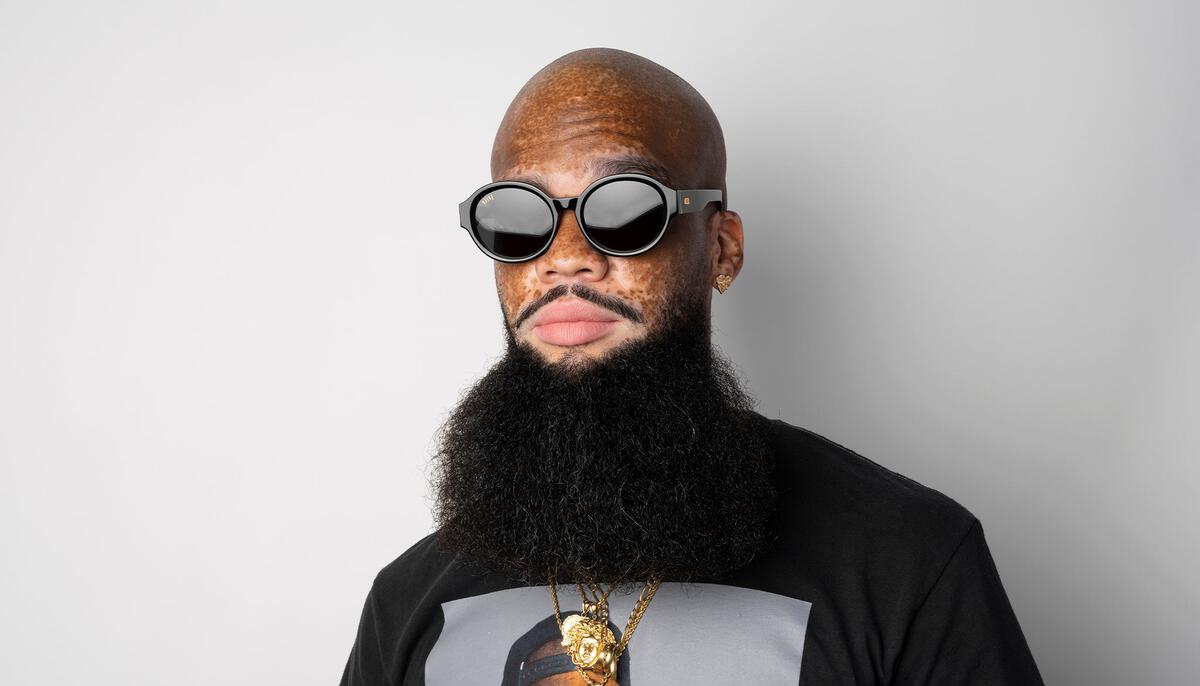 9FIVE Drips Black & 24K Gold Sunglasses